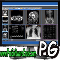 Sante PACS Server PG 3.1.2 Free Download